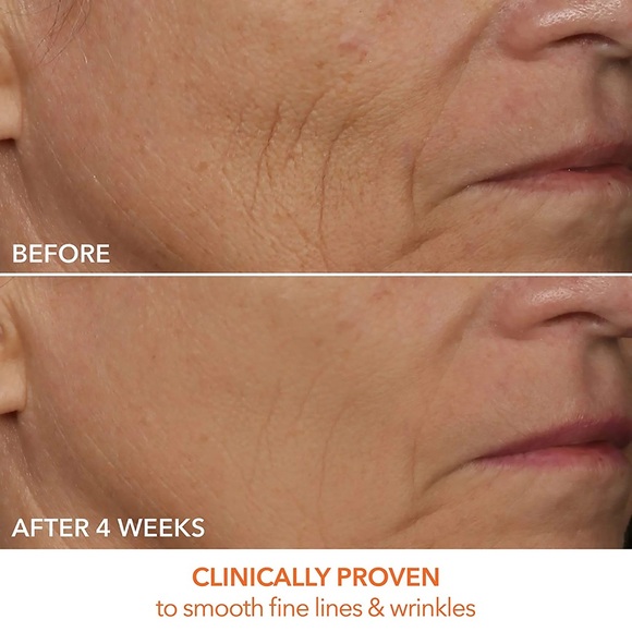 DRx SpectraLite™ FaceWare Pro 3-Minute LED Device - Picture 5 of 6